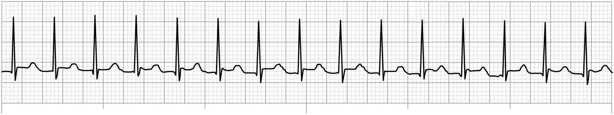 six-second-ecg-resources-skillstat